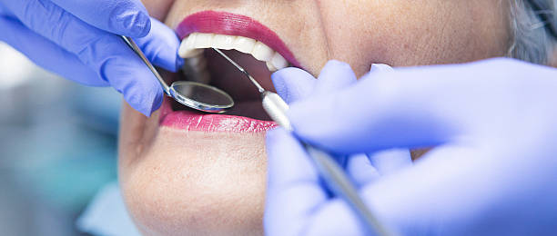 Best Knocked-Out Tooth (Avulsed Tooth) Treatment in Minnetonka, MN